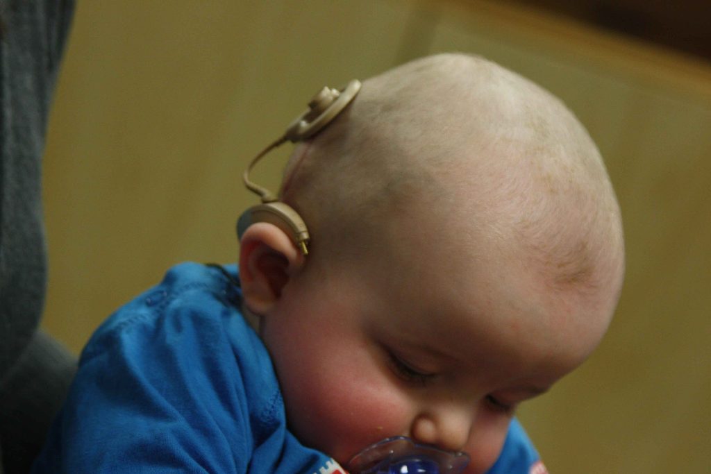 Cochlear Implantı Kimler Kullanmalıdır?